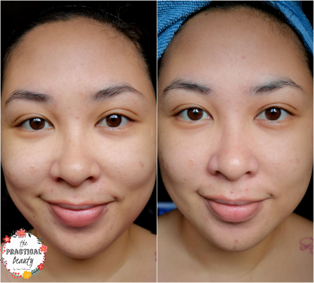 Neobeau Home Clinic Diamond 3-Step Peeling Program - NewLife PH - RESULTS | The Practical Beauty